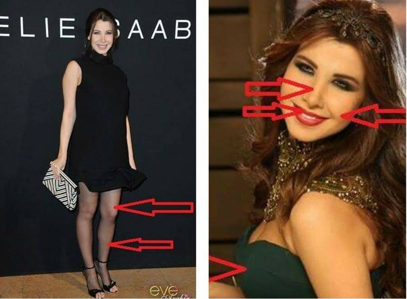 تعرف على العمليات التجميلية التي جعلت من بعض نجمات العالم العربي نساء أخريات..عمليات مي عزالدين ومنة شلبي الأغرب!
